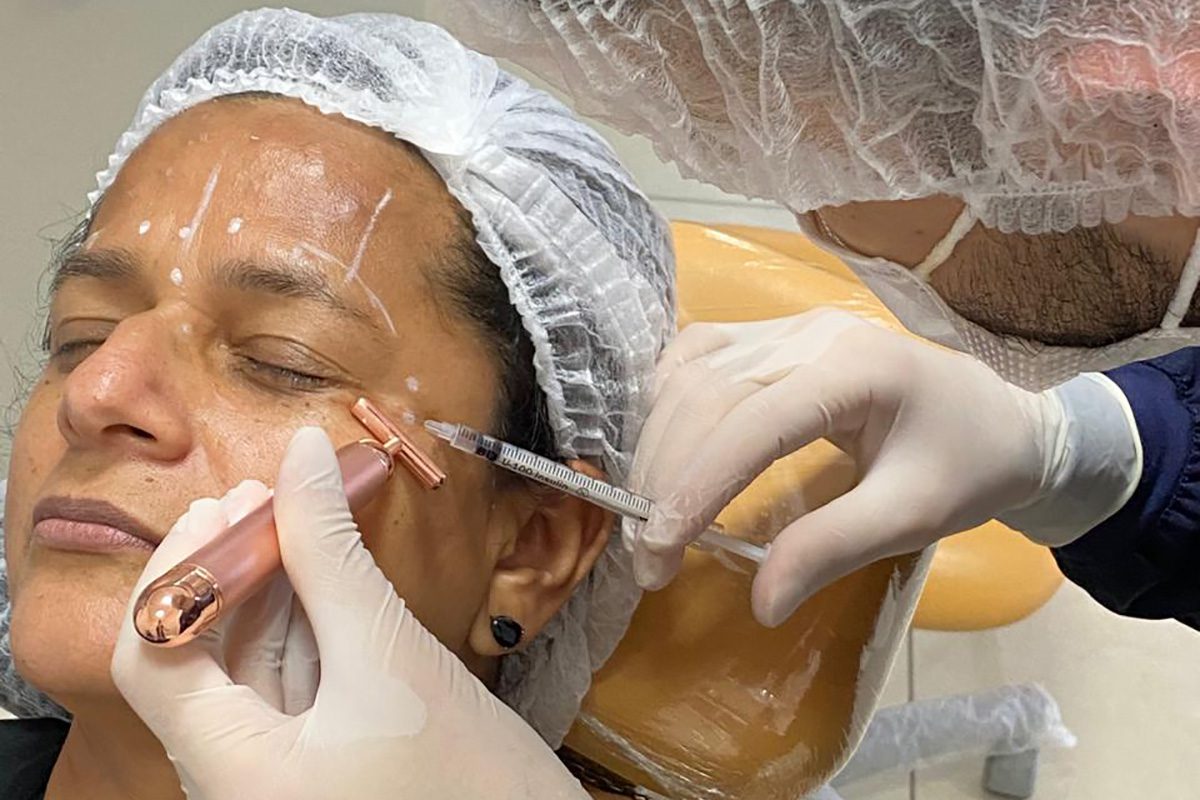 Botox Preventivo: Prevenção e Naturalidade com Dr. Nélio Novaes